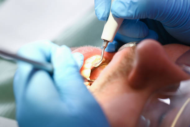 Best Emergency Gum Pain Relief  in Glenwood City, WI
